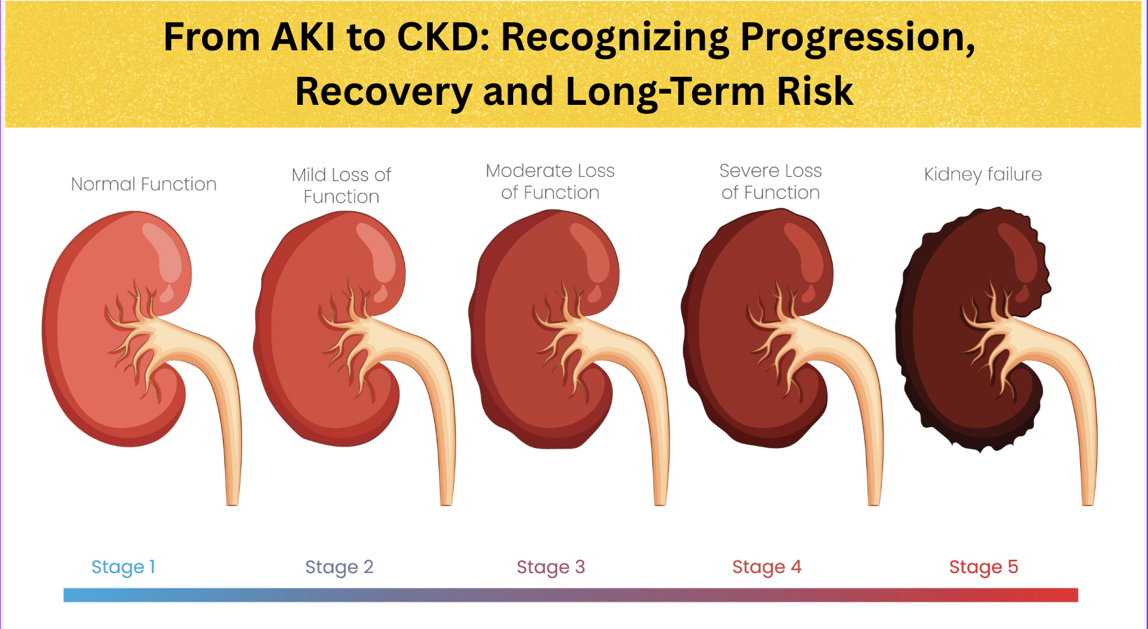 From AKI to CKD: Recognizing Progression, Recovery, and Long-Term Risk