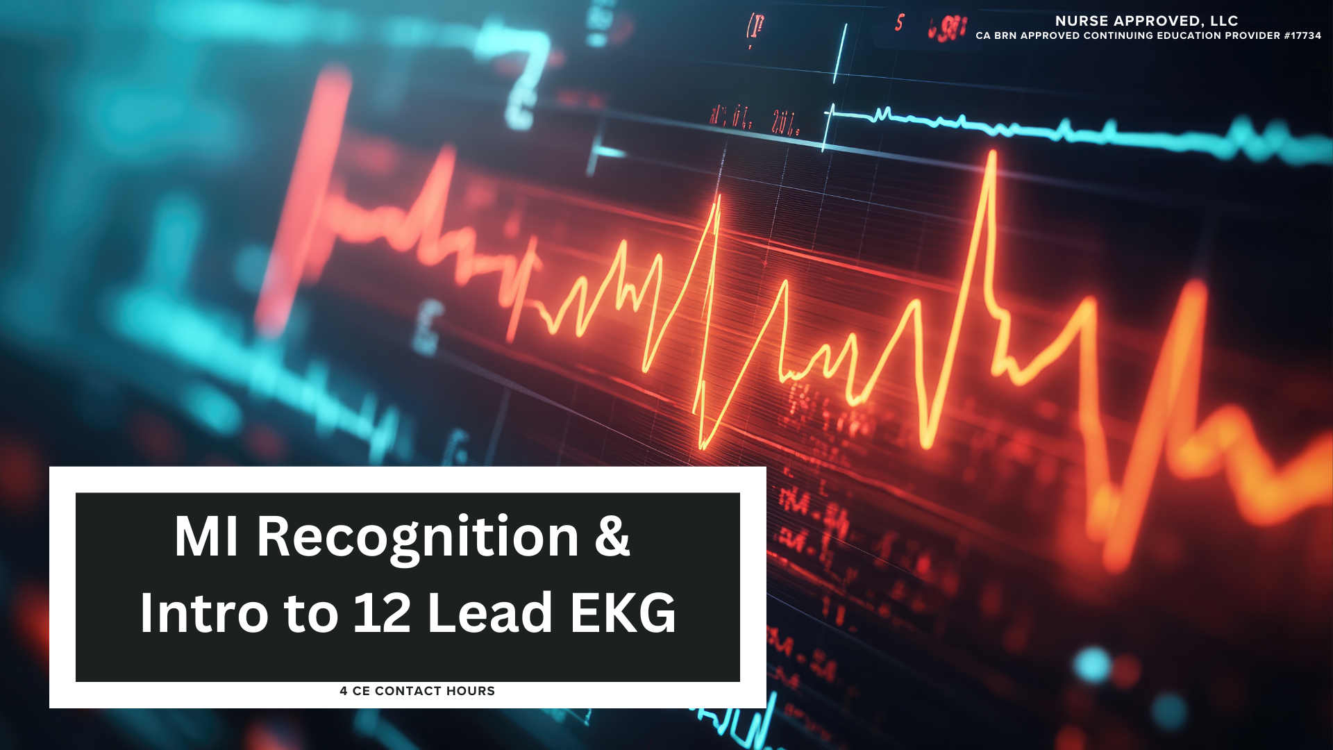 MI Recognition & Intro to 12-Lead EKGs