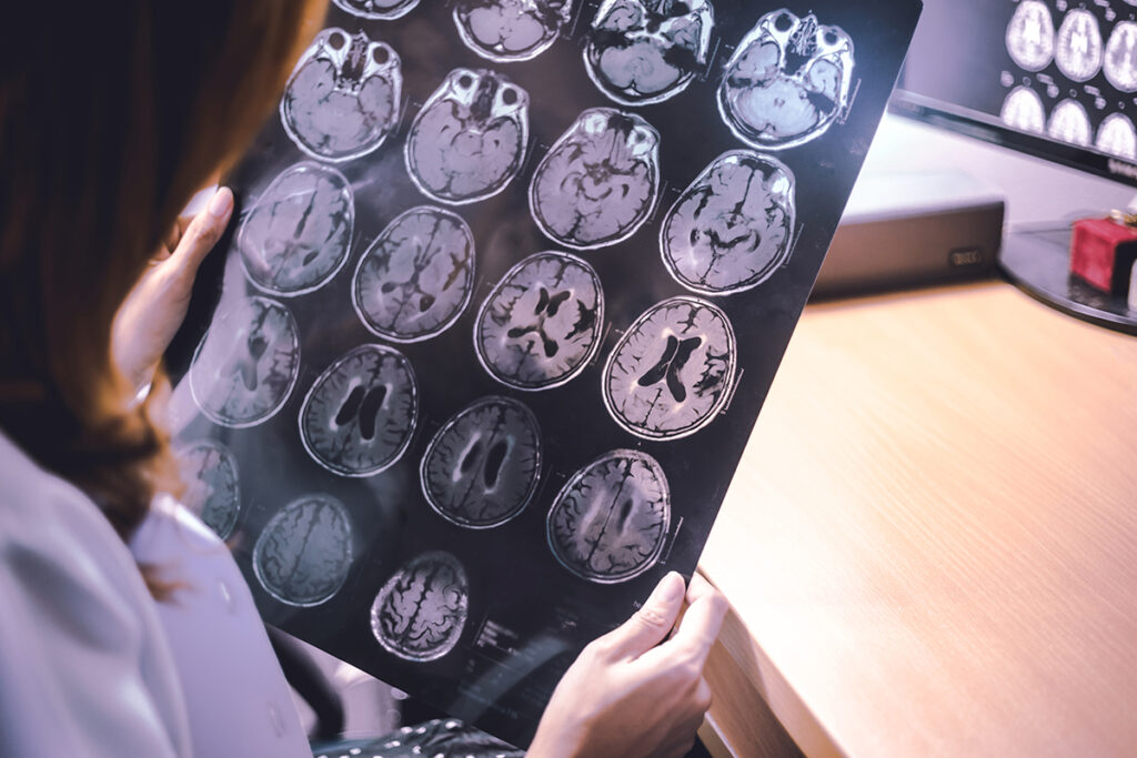Doctor reviewing brain MRI films